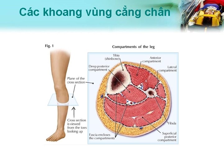 Các khoang vùng cẳng chân 