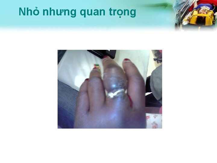 Nhỏ nhưng quan trọng 