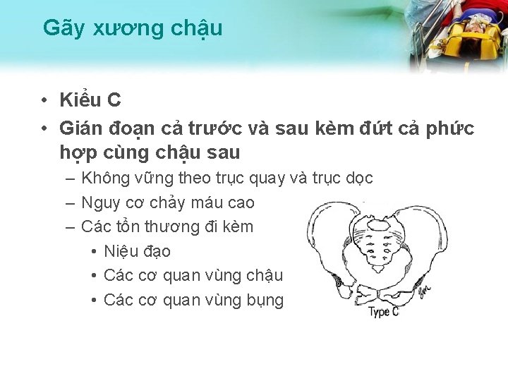 Gãy xương chậu • Kiểu C • Gián đoạn cả trước và sau kèm