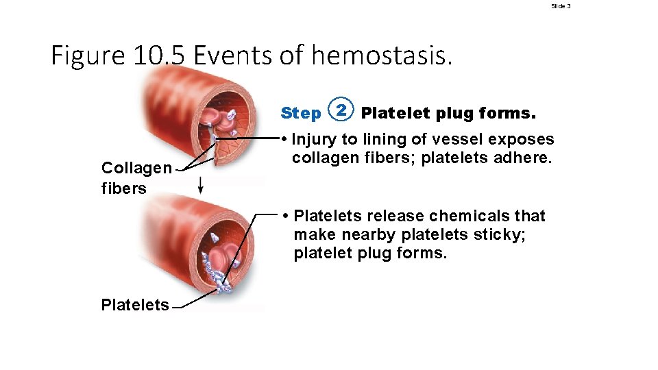 Slide 3 Figure 10. 5 Events of hemostasis. Step 2 Platelet plug forms. Collagen Slide 3 Figure 10. 5 Events of hemostasis. Step 2 Platelet plug forms. Collagen