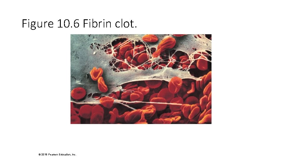 Figure 10. 6 Fibrin clot. © 2018 Pearson Education, Inc. 