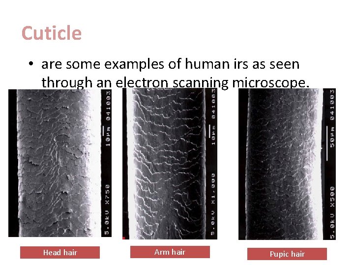 Cuticle • are some examples of human irs as seen through an electron scanning