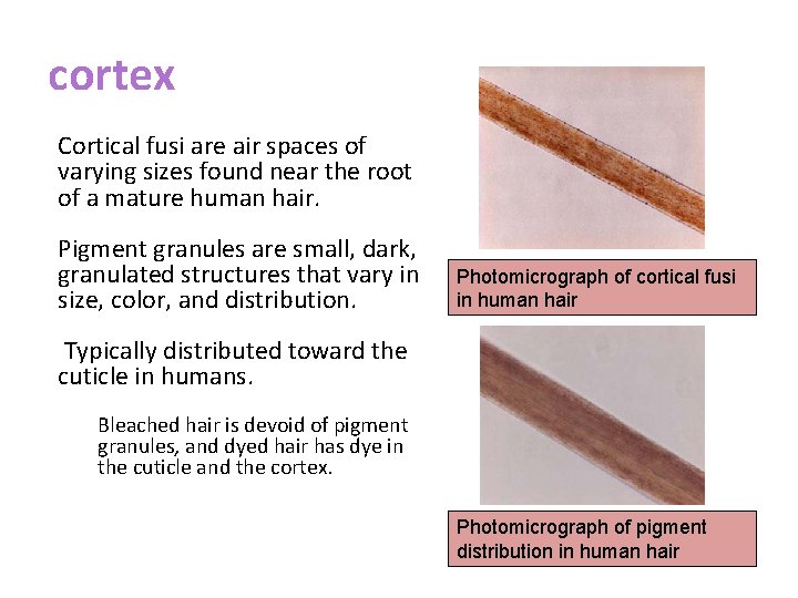 cortex Cortical fusi are air spaces of varying sizes found near the root of
