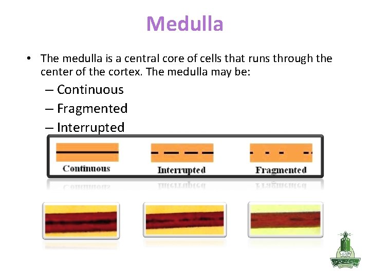 Medulla • The medulla is a central core of cells that runs through the