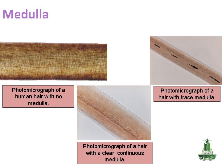 Medulla Photomicrograph of a human hair with no medulla. Photomicrograph of a hair with