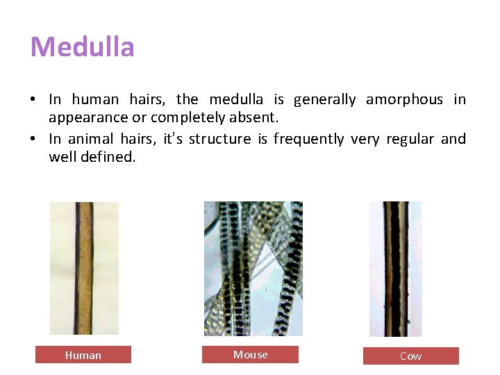 Medulla • In human hairs, the medulla is generally amorphous in appearance or completely