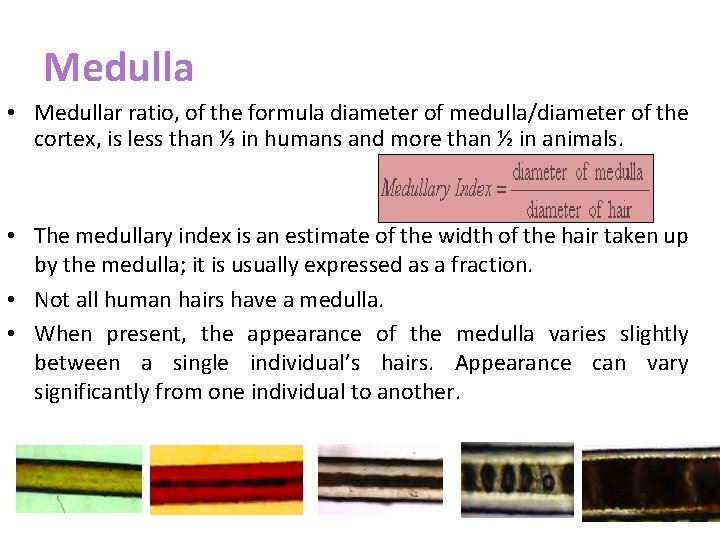 Medulla • Medullar ratio, of the formula diameter of medulla/diameter of the cortex, is