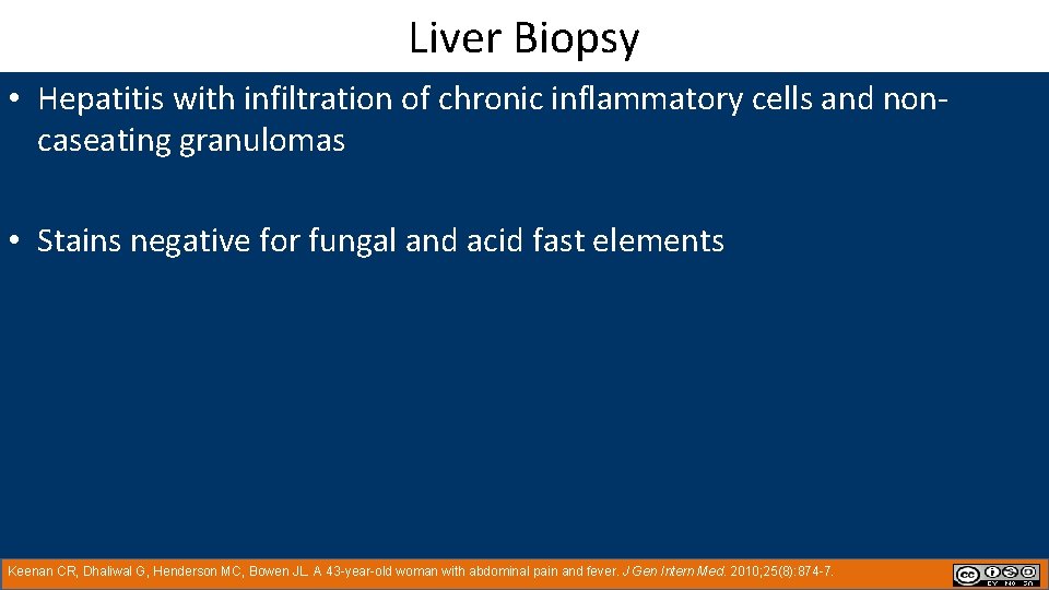 Liver Biopsy • Hepatitis with infiltration of chronic inflammatory cells and noncaseating granulomas •
