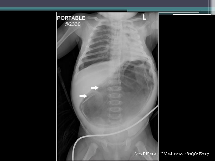 Lim RK et al. CMAJ 2010. 182(5): E 227. 