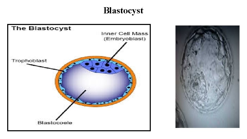 Blastocyst 