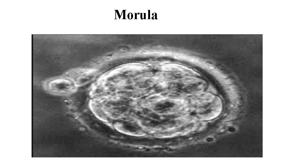 Morula 