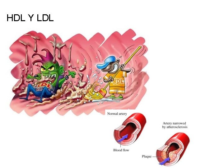 HDL Y LDL 