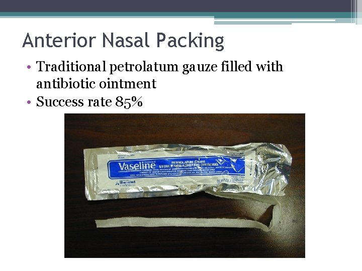 Anterior Nasal Packing • Traditional petrolatum gauze filled with antibiotic ointment • Success rate