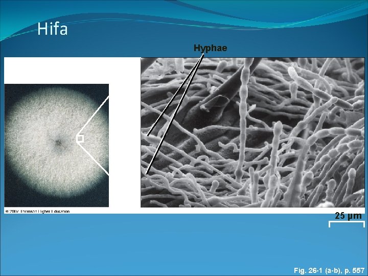 Hifa Hyphae 25 µm Fig. 26 -1 (a-b), p. 557 