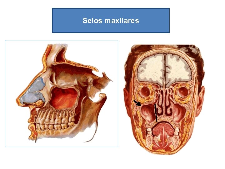 Seios maxilares 