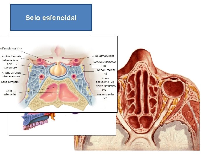 Seio esfenoidal 