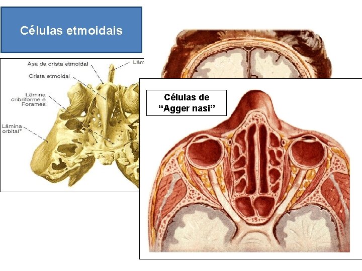 Células etmoidais Células de “Agger nasi” 