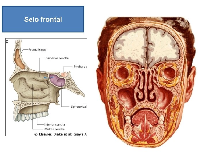 Seio frontal 