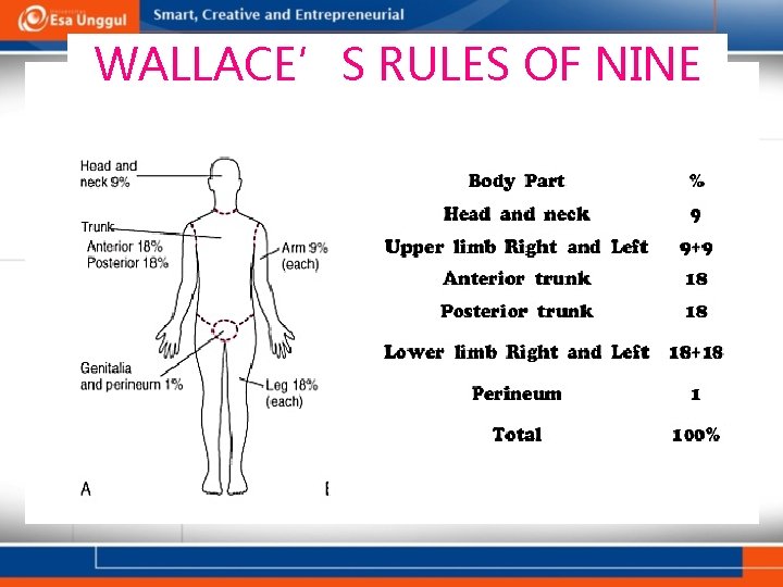 WALLACE’S RULES OF NINE 