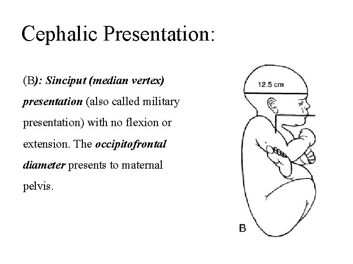 Cephalic Presentation: (B): Sinciput (median vertex) presentation (also called military presentation) with no flexion