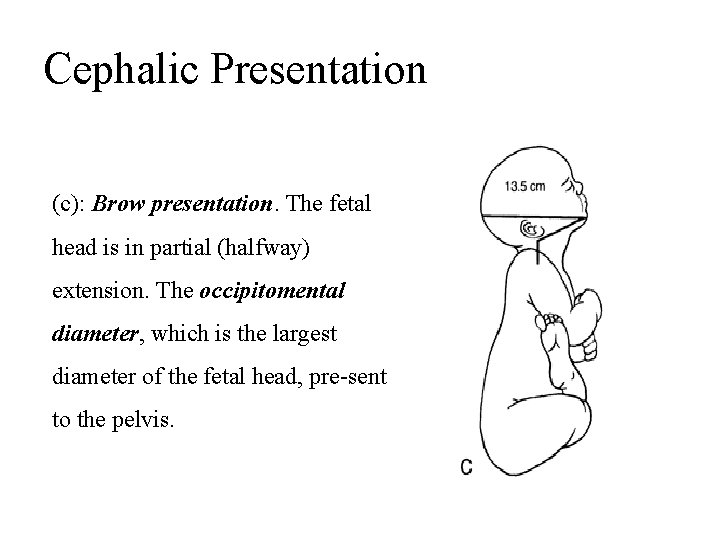 Cephalic Presentation (c): Brow presentation. The fetal head is in partial (halfway) extension. The