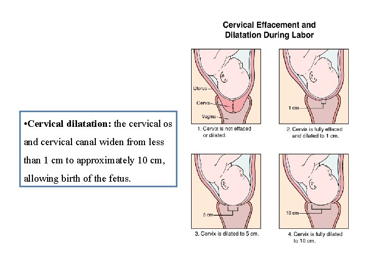  • Cervical dilatation: the cervical os and cervical canal widen from less than