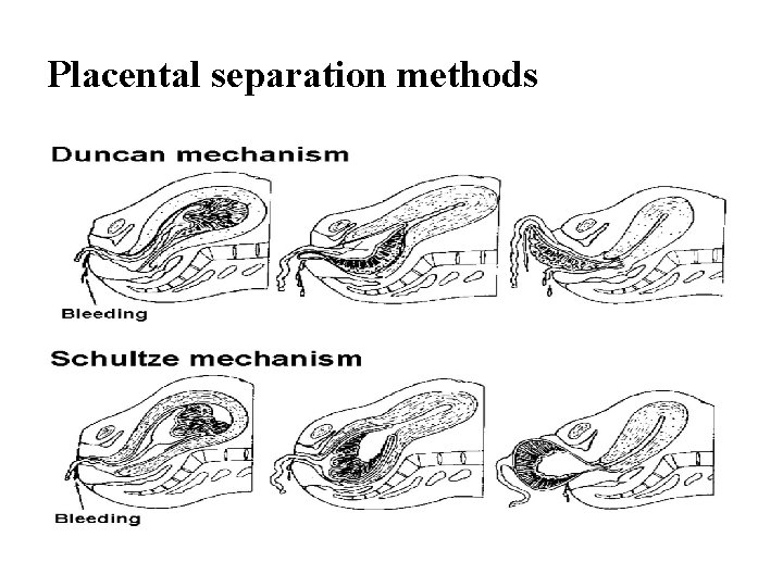 Placental separation methods 