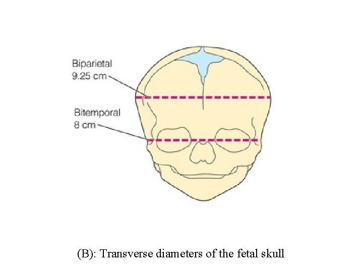 (B): Transverse diameters of the fetal skull 