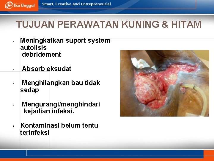 TUJUAN PERAWATAN KUNING & HITAM Meningkatkan suport system autolisis debridement • • • Absorb