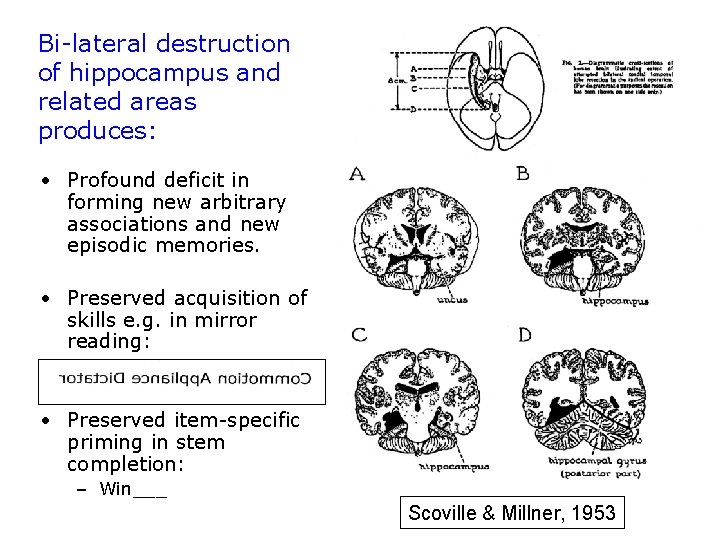Bi-lateral destruction of hippocampus and related areas produces: • Profound deficit in forming new