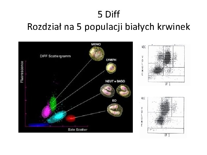 5 Diff Rozdział na 5 populacji białych krwinek 