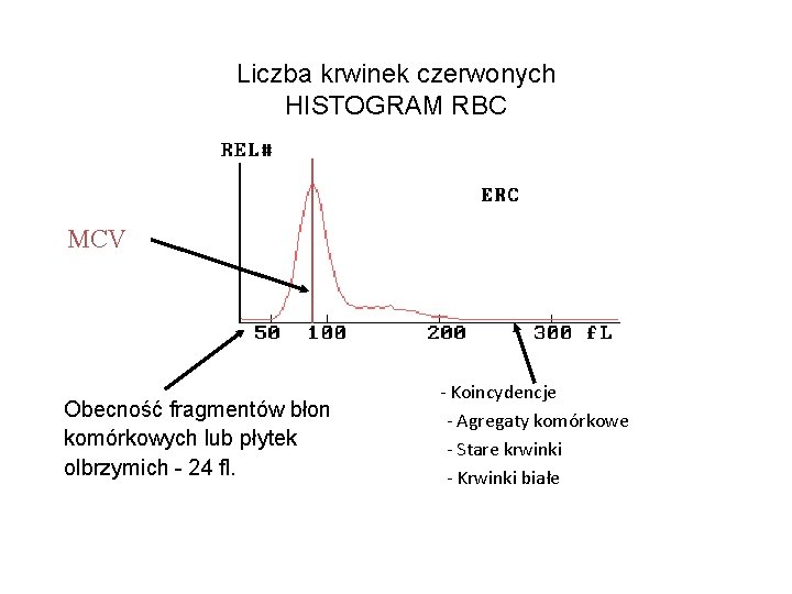 Liczba krwinek czerwonych HISTOGRAM RBC MCV Obecność fragmentów błon komórkowych lub płytek olbrzymich -