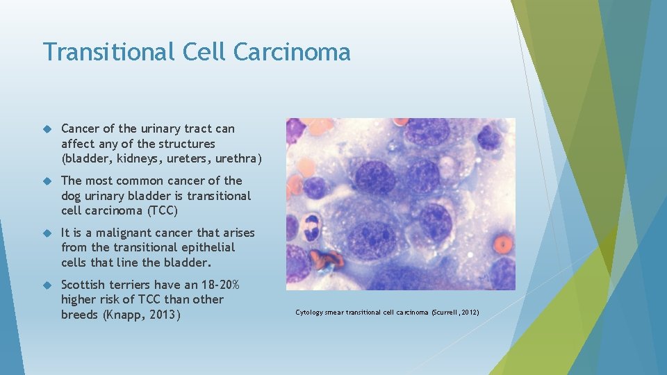 Transitional Cell Carcinoma Cancer of the urinary tract can affect any of the structures