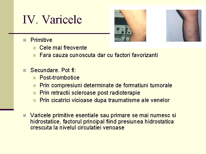 IV. Varicele n Primitive n n Cele mai frecvente Fara cauza cunoscuta dar cu