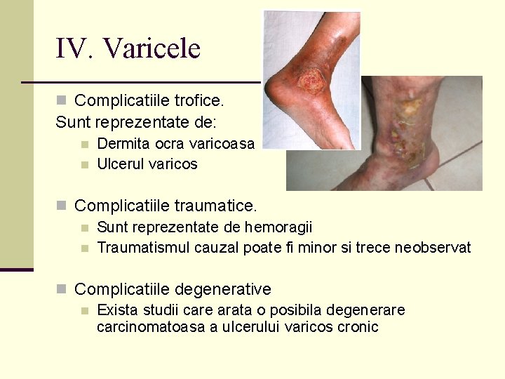 IV. Varicele n Complicatiile trofice. Sunt reprezentate de: n n Dermita ocra varicoasa Ulcerul