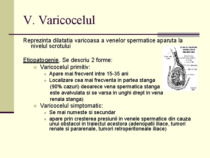 V. Varicocelul Reprezinta dilatatia varicoasa a venelor spermatice aparuta la nivelul scrotului Etiopatogenie. Se