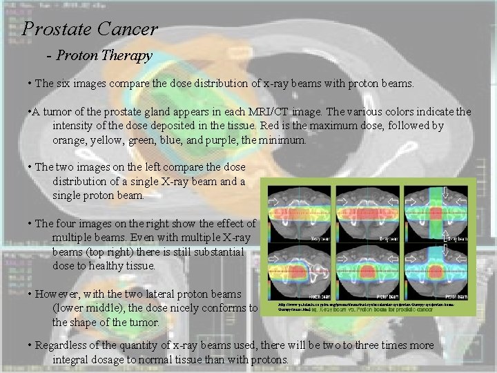 Prostate Cancer - Proton Therapy • The six images compare the dose distribution of