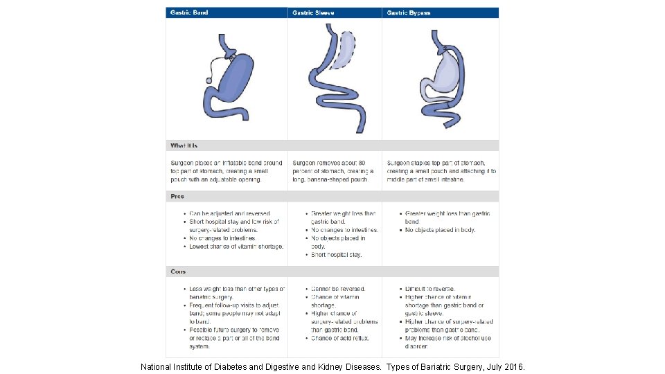 National Institute of Diabetes and Digestive and Kidney Diseases. Types of Bariatric Surgery, July