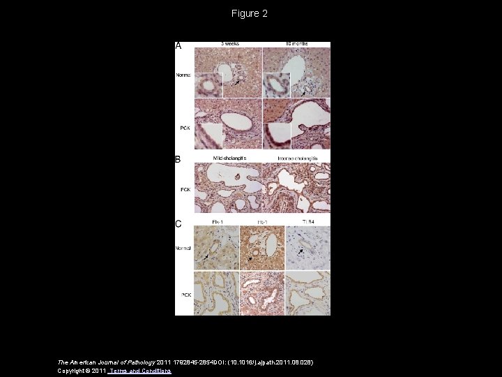 Figure 2 The American Journal of Pathology 2011 1792845 -2854 DOI: (10. 1016/j. ajpath.