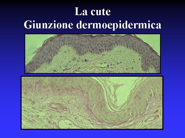 La cute Giunzione dermoepidermica 