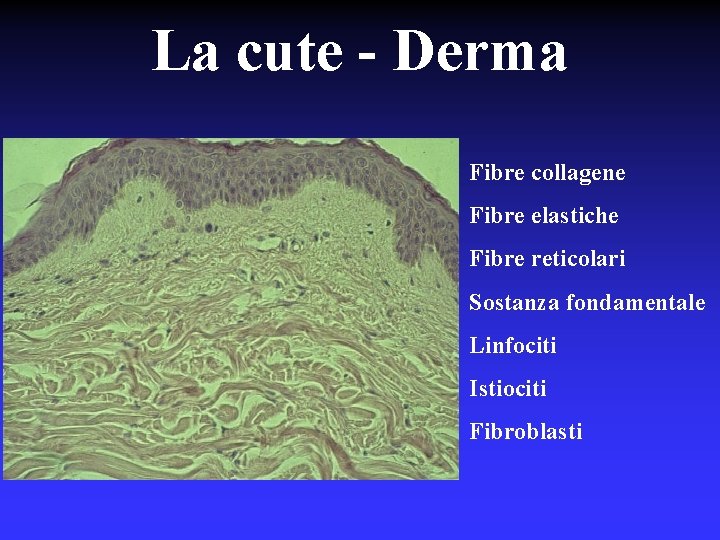 La cute - Derma Fibre collagene Fibre elastiche Fibre reticolari Sostanza fondamentale Linfociti Istiociti