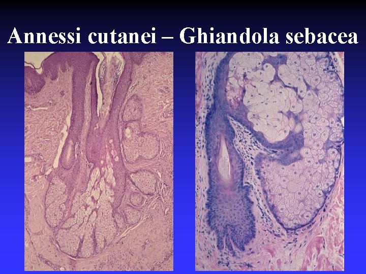 Annessi cutanei – Ghiandola sebacea 