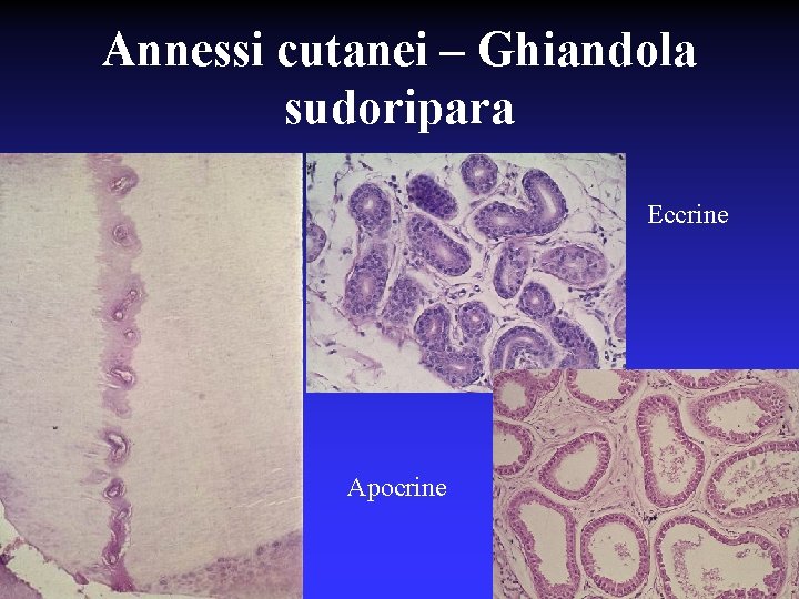 Annessi cutanei – Ghiandola sudoripara Eccrine Apocrine 