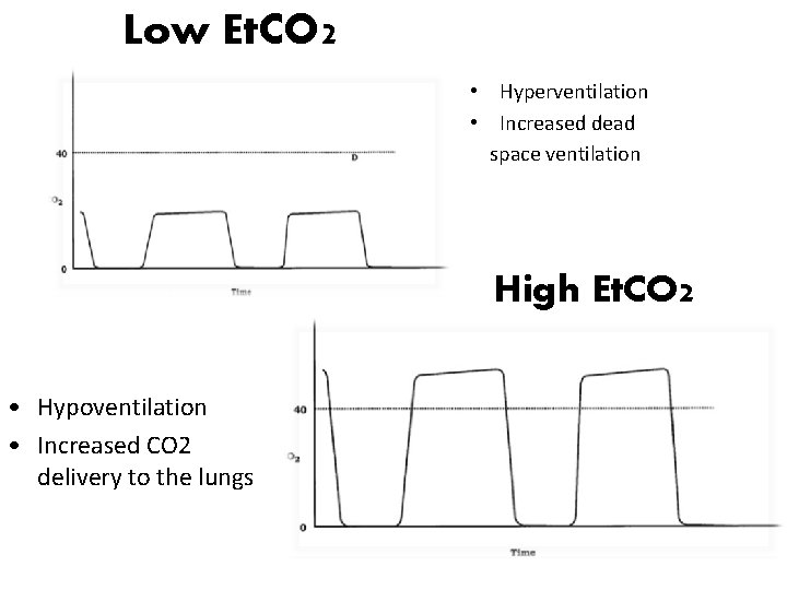Low Et. CO 2 • Hyperventilation • Increased dead space ventilation High Et. CO