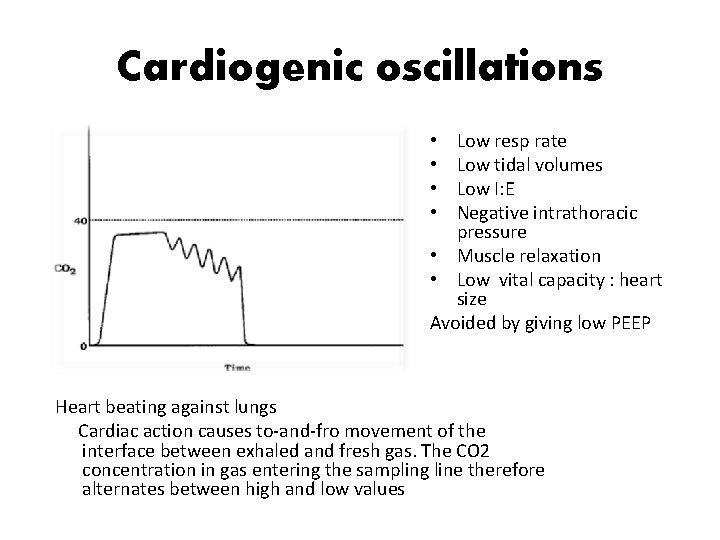 Cardiogenic oscillations Low resp rate Low tidal volumes Low I: E Negative intrathoracic pressure