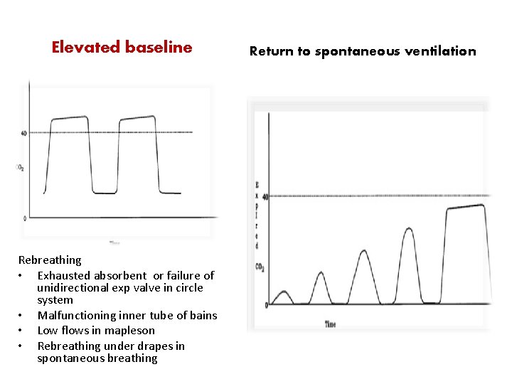 Elevated baseline Rebreathing • Exhausted absorbent or failure of unidirectional exp valve in circle