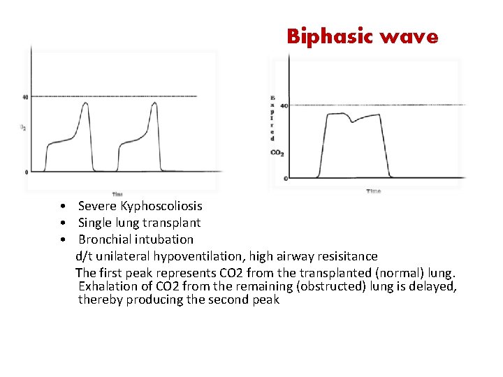 Biphasic wave Severe Kyphoscoliosis • Leak • in sampling line during • Single lung