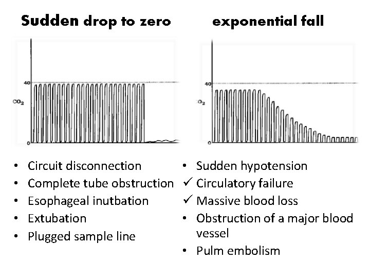 Sudden drop to zero • • • Circuit disconnection Complete tube obstruction Esophageal inutbation