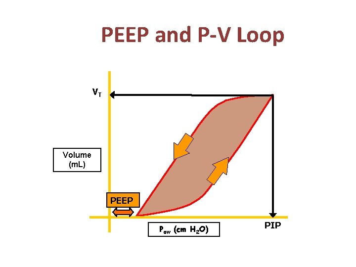 PEEP and P-V Loop VT Volume (m. L) PEEP Paw (cm H 2 O)