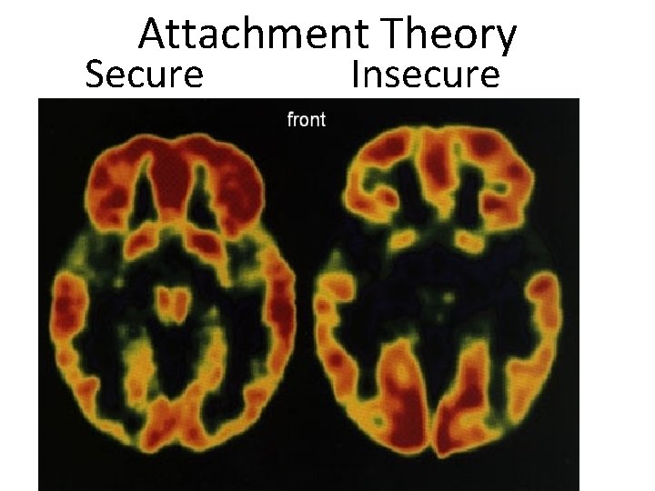 Attachment Theory Secure Insecure 